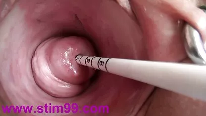 Extrema real cervix maldito objeto de inserción en utherus xxx de viejas culonas