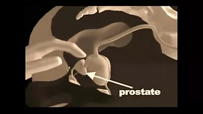Técnicas de masaje de próstata xxx amateur ecuador