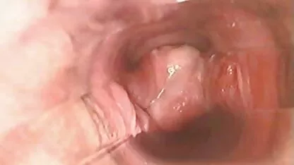 Dentro de Coño durante el orgasmo l7 caseros xxx méxico