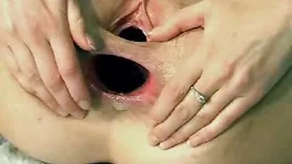 Webcam chica enorme anal & prolapso xxx de mexicana