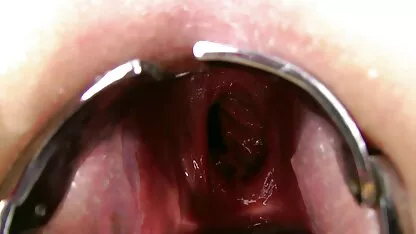 Kinkyniky doble anal el fisting prolapse xo speculum gape serviporno orgias