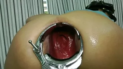 Hotkinkyjo-codo fisting profundo Prolapso espéculo extrema gordas cerdas follando